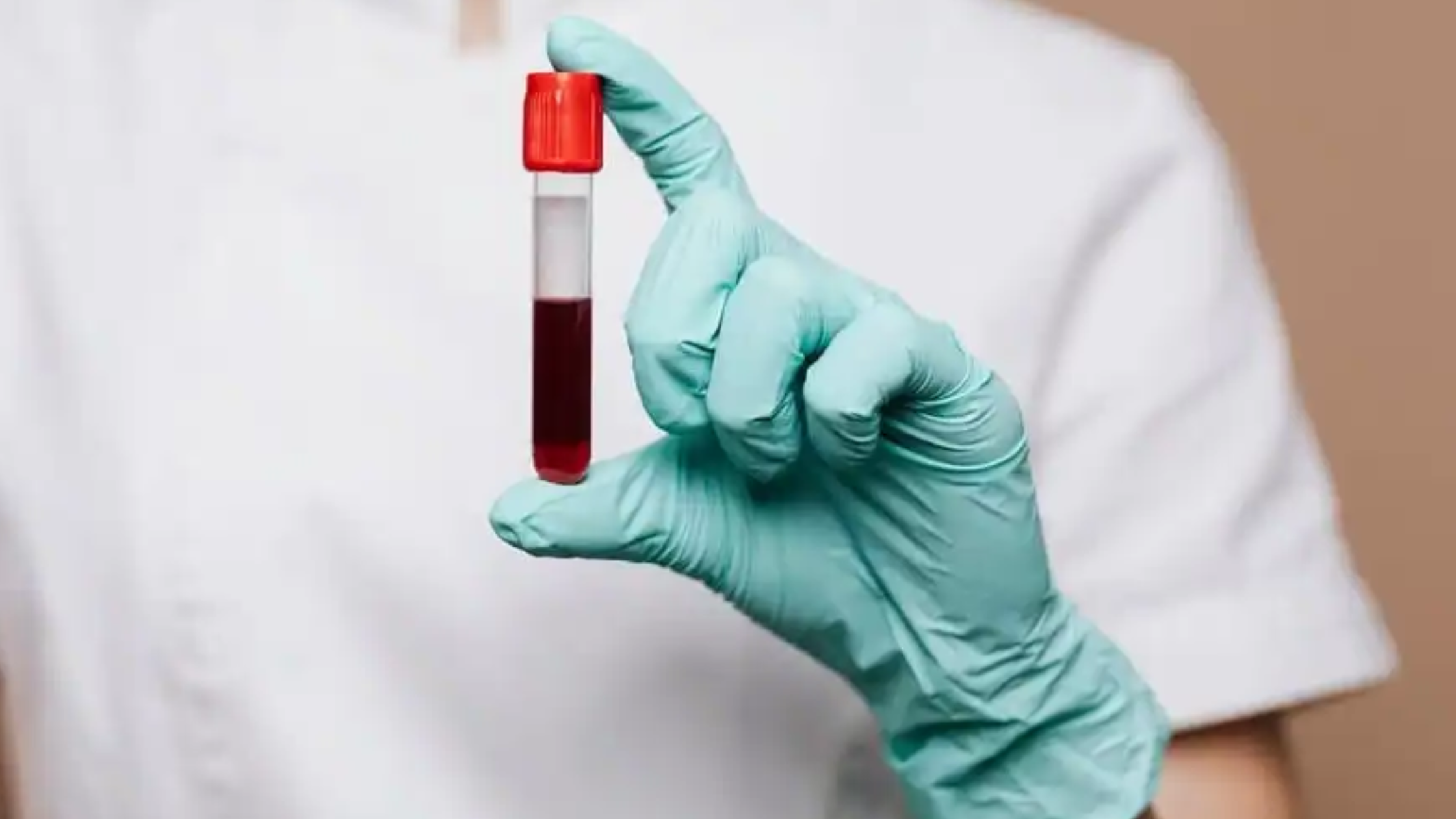 Types of Blood Tests for Angina