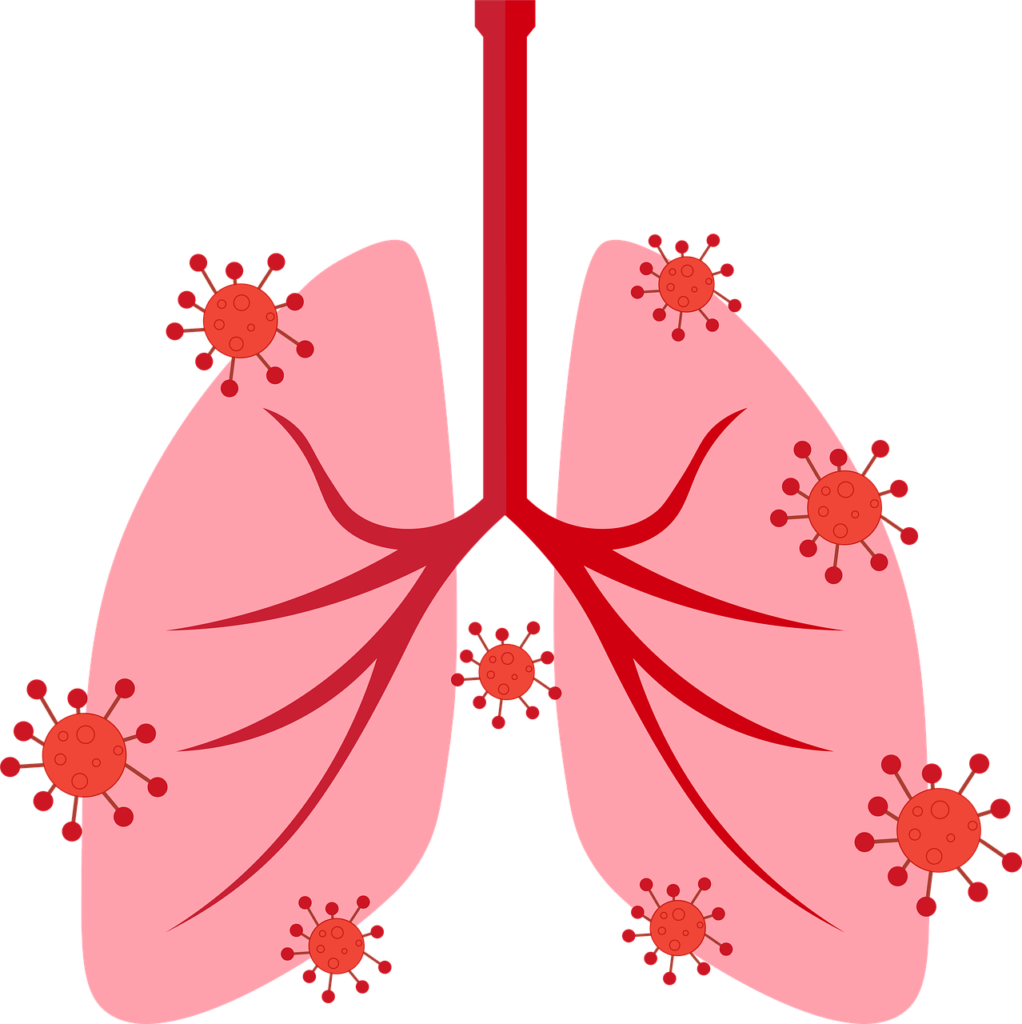 Overview of Lung Infection and its Types