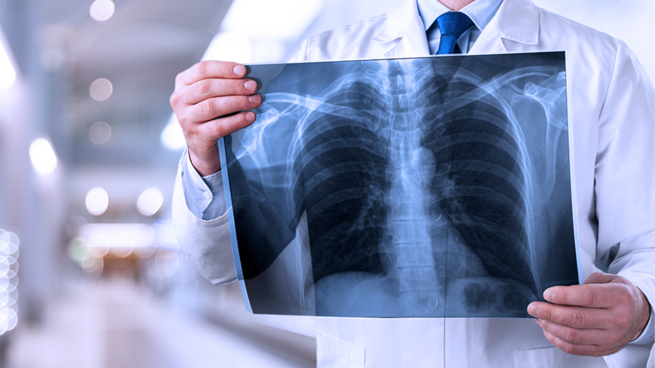 Airbag Injuries to Chest: Essential Knowledge! Airbag Injuries to Chest