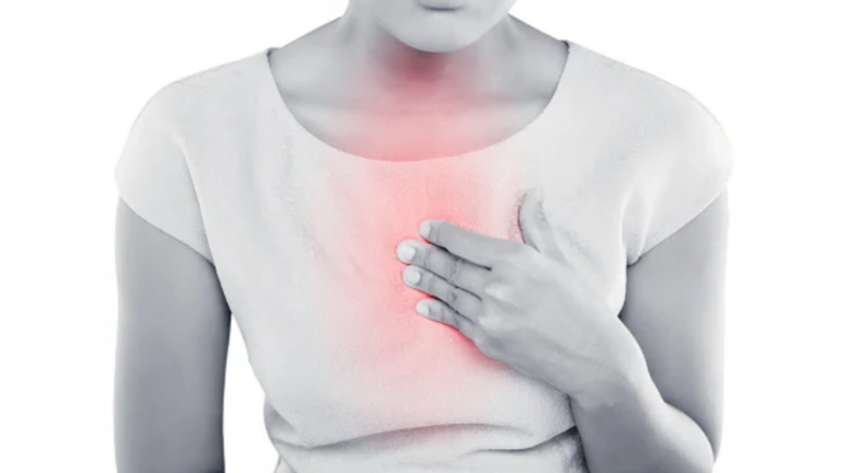 Substernal Chest Pain ICD-10: What You Must Know!