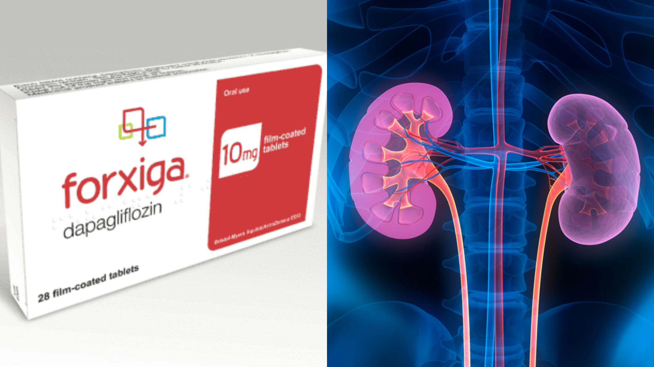 Is Forxiga Bad for Kidneys? is forxiga bad for kidneys?